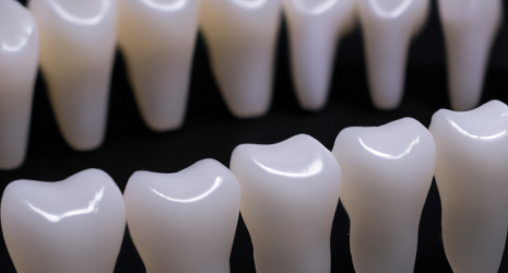 ¿Cuáles son los tipos de blanqueamiento dental?