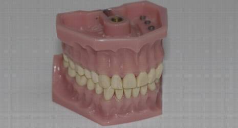 Estudio revela la importancia de la limpieza regular de los estuches para prótesis dentales